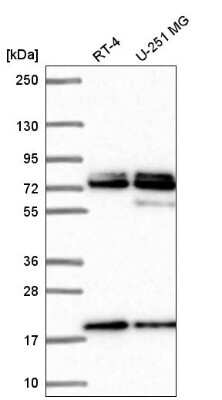 Western Blot: Nucleoporin NUP85 Antibody [NBP2-56709]