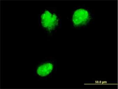 Immunocytochemistry/ Immunofluorescence: NUP62 Antibody (2D3) [H00023636-M02]