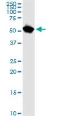 Western Blot: NUP62 Antibody (2D3) [H00023636-M02]
