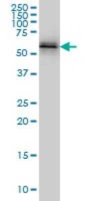 Western Blot: NUP62 Antibody (2D3) [H00023636-M02]