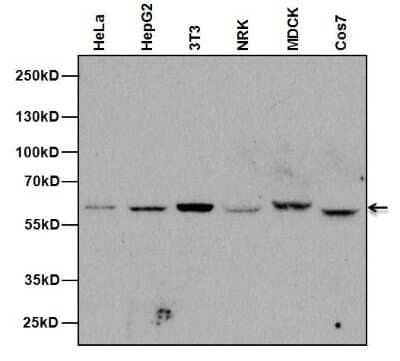 Western Blot: NUP62 Antibody (RL31) [NB120-2736]