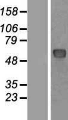 Western Blot: NUP62 Overexpression Lysate [NBP2-05223]