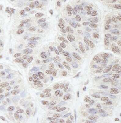 Immunohistochemistry: Nucleostemin Antibody [NB100-1568]