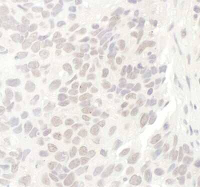Immunohistochemistry: Nucleostemin Antibody [NB100-1569]