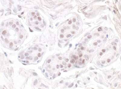 Immunohistochemistry: Nucleostemin Antibody [NB100-1569]