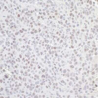 Immunohistochemistry: Nucleostemin Antibody [NB100-1569]