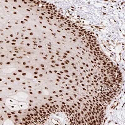 Immunohistochemistry: Nucleostemin Antibody [NBP2-38326]