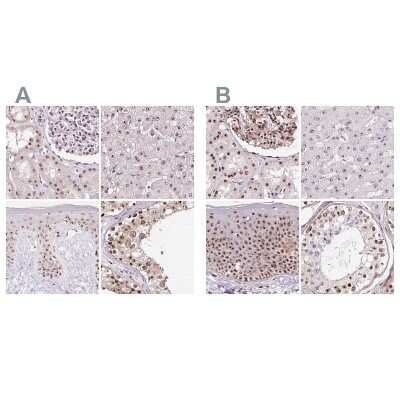 Immunohistochemistry-Paraffin: Nucleostemin Antibody [NBP2-38325]