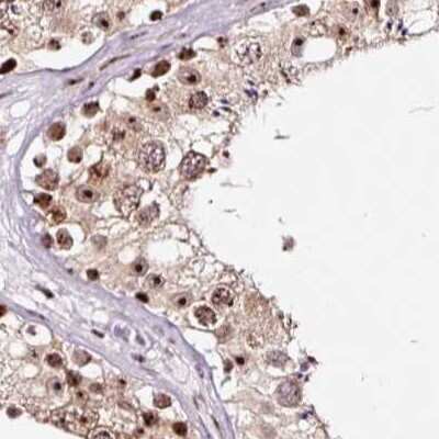 Immunohistochemistry-Paraffin: Nucleostemin Antibody [NBP2-38325]