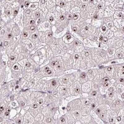 Immunohistochemistry-Paraffin: Nucleostemin Antibody [NBP2-38325]