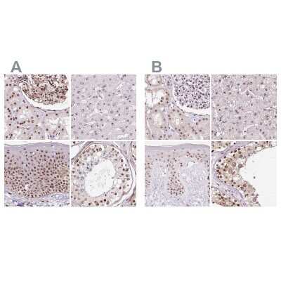 Immunohistochemistry-Paraffin: Nucleostemin Antibody [NBP2-38326]