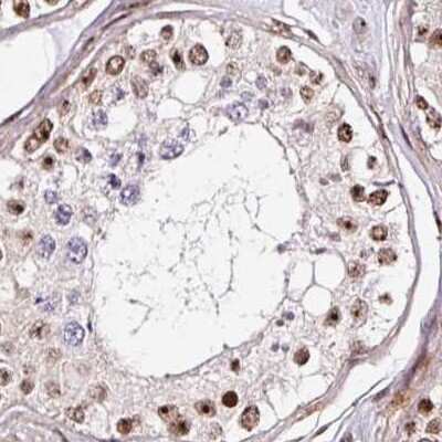 Immunohistochemistry-Paraffin: Nucleostemin Antibody [NBP2-38326]