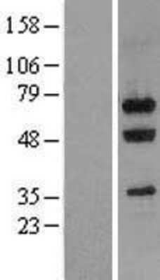 Western Blot: Nucleostemin Overexpression Lysate [NBL1-11183]