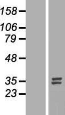 Western Blot: Nucleotide binding protein like Overexpression Lysate [NBL1-13847]