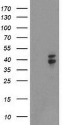 Western Blot: Nudel Antibody (OTI5E11)Azide and BSA Free [NBP2-73104]