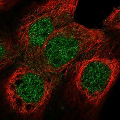 Immunocytochemistry/ Immunofluorescence: Nuf2 Antibody [NBP2-55985]