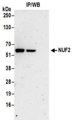 Immunoprecipitation: Nuf2 Antibody [NBP2-32210]