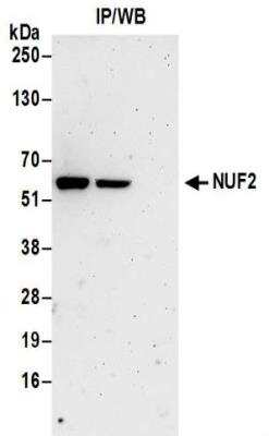 Immunoprecipitation: Nuf2 Antibody [NBP2-32211]
