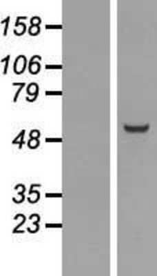 Western Blot: Nuf2 Overexpression Lysate [NBP2-09983]