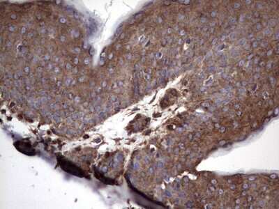 Immunohistochemistry: Numb Antibody (OTI1B5) [NBP2-46284]