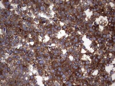 Immunohistochemistry: Numb Antibody (OTI1B5) [NBP2-46284]
