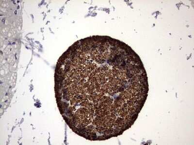 Immunohistochemistry: Numb Antibody (OTI1B5) [NBP2-46284]