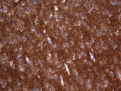 Immunohistochemistry: Numb Antibody (OTI1B5) [NBP2-46284]