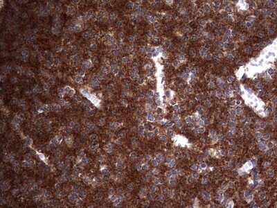 Immunohistochemistry: Numb Antibody (OTI1B5) [NBP2-46284]