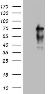 Western Blot: Numb Antibody (OTI1B5) [NBP2-46284]