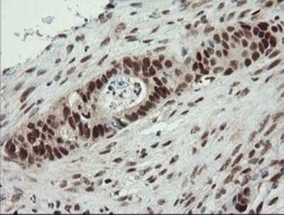 Immunohistochemistry: Numb Antibody (OTI4F3) [NBP2-45877]