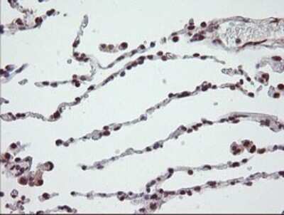 Immunohistochemistry: Numb Antibody (OTI4F3) [NBP2-45877]