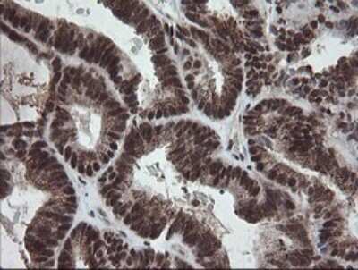 Immunohistochemistry: Numb Antibody (OTI4F3) [NBP2-45877]