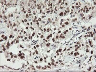 Immunohistochemistry: Numb Antibody (OTI4F3) [NBP2-45877]
