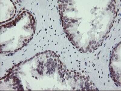 Immunohistochemistry: Numb Antibody (OTI4F3) [NBP2-45877]