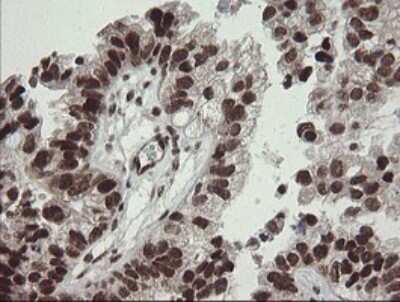 Immunohistochemistry: Numb Antibody (OTI4F3) [NBP2-45877]