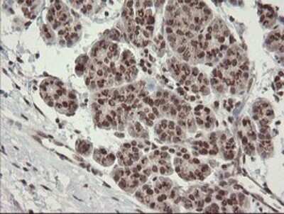 Immunohistochemistry: Numb Antibody (OTI4F3) [NBP2-45877]