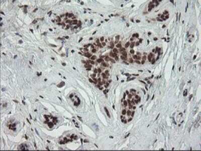 Immunohistochemistry: Numb Antibody (OTI4F3) [NBP2-45877]