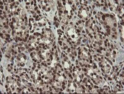 Immunohistochemistry: Numb Antibody (OTI4F3) [NBP2-45877]
