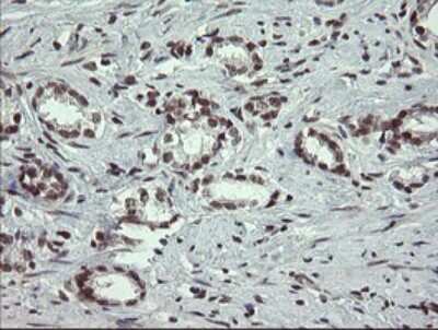 Immunohistochemistry: Numb Antibody (OTI4F3) [NBP2-45877]