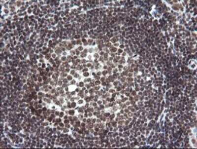 Immunohistochemistry: Numb Antibody (OTI4F3) [NBP2-45877]
