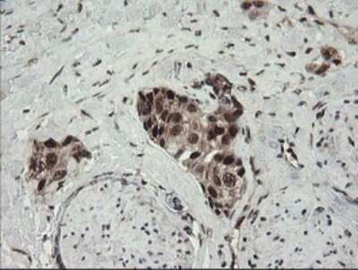 Immunohistochemistry: Numb Antibody (OTI4F3) [NBP2-45877]