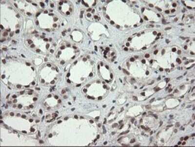Immunohistochemistry: Numb Antibody (OTI4F3) [NBP2-45877]