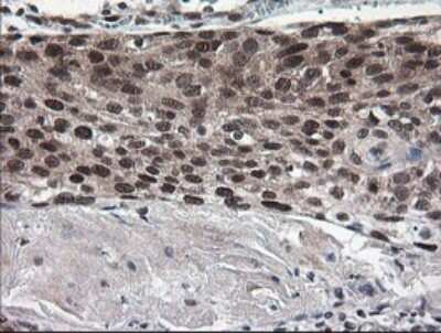 Immunohistochemistry: Numb Antibody (OTI4F3) [NBP2-45877]