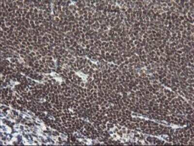 Immunohistochemistry: Numb Antibody (OTI4F3) [NBP2-45877]