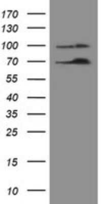 Western Blot: Numb Antibody (OTI4F3) [NBP2-45877]