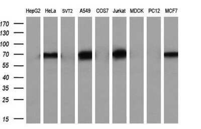 Western Blot: Numb Antibody (OTI4F3) [NBP2-45877]