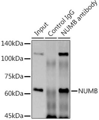 Immunoprecipitation: Numb Antibody (9X1Y0) [NBP3-16738]