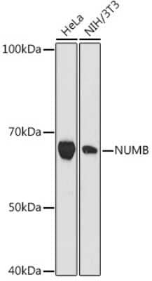 Western Blot: Numb Antibody (9X1Y0) [NBP3-16738]