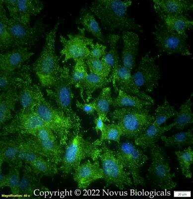 Immunocytochemistry/ Immunofluorescence: Numb Antibody [NB500-178]