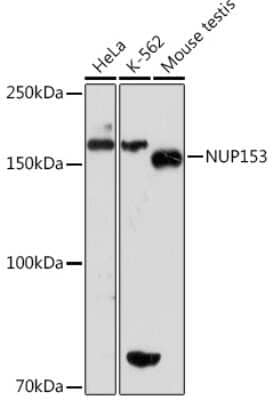 Western Blot: Nup153 Antibody (3I5V3) [NBP3-16136]